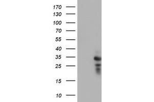 HEK293T cells were transfected with the pCMV6-ENTRY control (Left lane) or pCMV6-ENTRY HDHD1 (Right lane) cDNA for 48 hrs and lysed. (HDHD1 antibody)