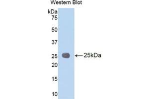 Western blot analysis of the recombinant protein. (IL1RAP antibody  (AA 65-249))