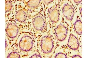 Immunohistochemistry of paraffin-embedded human colon tissue using ABIN7151699 at dilution of 1:100 (ERGIC3 antibody  (AA 47-341))