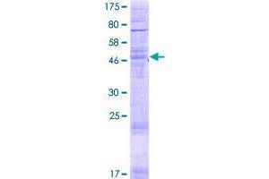 Image no. 1 for TLC Domain Containing 1 (TLCD1) (AA 1-247) protein (GST tag) (ABIN1322832) (TLCD1 Protein (AA 1-247) (GST tag))