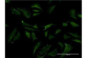 Immunofluorescence of monoclonal antibody to ABCB9 on HeLa cell. (ABCB9 antibody  (AA 482-580))