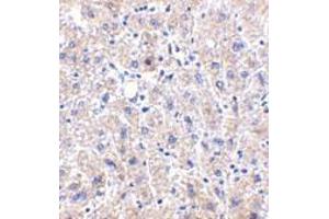 Immunohistochemistry of DRAM in human liver tissue with DRAM antibody at 2. (DRAM antibody  (C-Term))