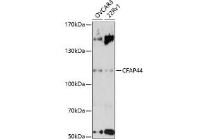 Western blot analysis of extracts of various cell lines, using CF antibody (ABIN7271360) at 1:3000 dilution. (WDR52 antibody  (AA 180-370))
