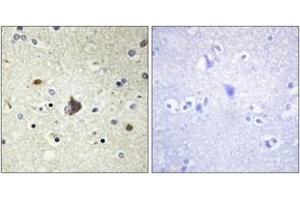 Immunohistochemistry analysis of paraffin-embedded human brain tissue, using Collagen IV alpha3 Antibody. (COL4a3 antibody  (AA 801-850))