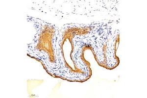 Immunohistochemistry analysis of paraffin embedded mouse bladder using TGDS (ABIN7075850) at dilution of 1: 1500 (TGDS antibody)