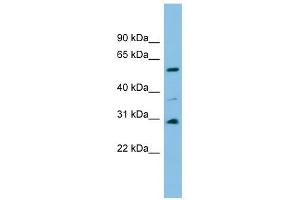 DUS1L antibody used at 1 ug/ml to detect target protein.