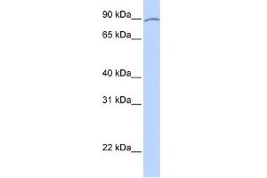WB Suggested Anti-KIAA0317 Antibody Titration:  0. (AREL1 antibody  (Middle Region))