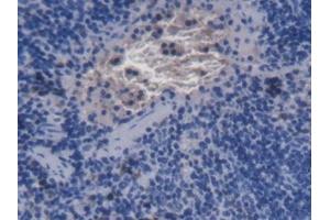 Detection of aHSP in Mouse Spleen Tissue using Monoclonal Antibody to Alpha-Hemoglobin Stabilizing Protein (aHSP) (aHSP antibody  (AA 2-102))