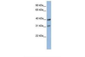 Image no. 1 for anti-Cytochrome C Oxidase Subunit 3 (COX-3) (AA 182-231) antibody (ABIN6738694) (COX3 antibody  (AA 182-231))