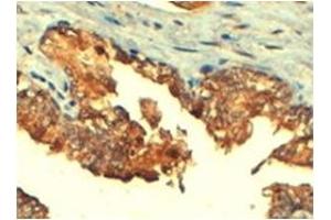 Image no. 1 for anti-ATP-Binding Cassette, Sub-Family C (CFTR/MRP), Member 4 (ABCC4) (C-Term) antibody (ABIN374484) (ABCC4 antibody  (C-Term))