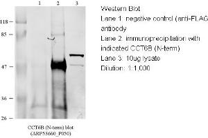 WB Suggested Anti-CCT4 Antibody Titration: 1 ug/mlLane 1: 10ug of HEK293 (CCT6B antibody  (N-Term))