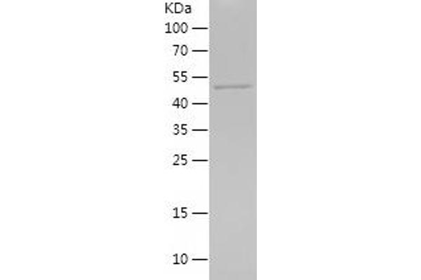 IL11RA Protein (AA 145-362) (His-IF2DI Tag)