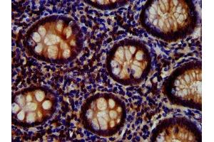 IHC image of ABIN7167024 diluted at 1:700 and staining in paraffin-embedded human appendix tissue performed on a Leica BondTM system. (AKT1 antibody  (AA 1-480))