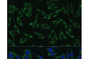 Immunofluorescence analysis of L929 cells using DICER1 Polyclonal Antibody at dilution of 1:100 (40x lens). (DICER1 antibody)