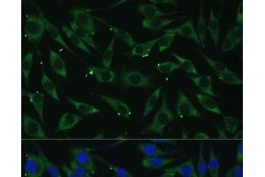 Immunofluorescence analysis of L929 cells using DICER1 Polyclonal Antibody at dilution of 1:100 (40x lens).