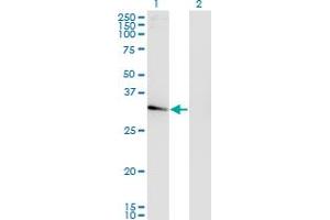 Western Blot analysis of NACA2 expression in transfected 293T cell line by NACAL monoclonal antibody (M01), clone 4H6. (NACA2 antibody  (AA 116-215))