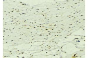 ABIN6272619 at 1/100 staining Mouse muscle tissue by IHC-P.