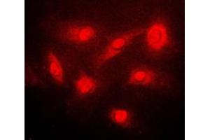 Immunofluorescent analysis of IKK beta (pS23) staining in PC12 cells. (IKBKB antibody  (N-Term, pSer23))