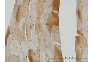 Immunoperoxidase of monoclonal antibody to CRYM on formalin-fixed paraffin-embedded human skeletal muscle. (CRYM antibody  (AA 215-314))