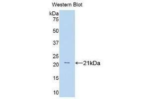 Detection of Recombinant TNFa, Rat using Polyclonal Antibody to Tumor Necrosis Factor Alpha (TNFa) (TNF alpha antibody  (AA 80-235))