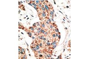 Image no. 2 for anti-RAD9 Homolog A (S. Pombe) (RAD9A) (AA 1-100), (BH3 Domain), (N-Term) antibody (ABIN356831) (RAD9A antibody  (BH3 Domain, N-Term))