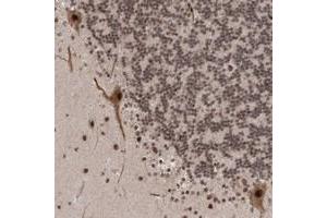 Immunohistochemical staining of human cerebellum with ZNF592 polyclonal antibody  shows strong nuclear positivity in purkinje cells at 1:10-1:20 dilution. (ZNF592 antibody)