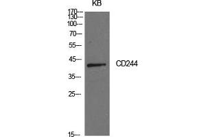 Western Blotting (WB) image for anti-Natural Killer Cell Receptor 2B4 (CD244) antibody (ABIN5959144) (2B4 antibody)