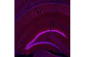 Indirect immunostaining of a PFA fixed mouse brain section (dilution 1 : 500; red).