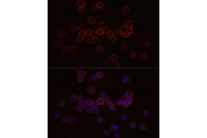 Immunofluorescence analysis of R. (F4/80 antibody)