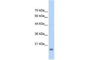WB Suggested Anti-AMFR Antibody Titration:  2. (AMFR antibody  (C-Term))
