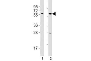Western Blotting (WB) image for anti-SRY (Sex Determining Region Y)-Box 10 (SOX10) (AA 231-259) antibody (ABIN3032721)