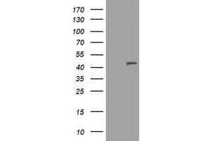 Image no. 1 for anti-Melanoma Antigen Family A, 3 (MAGEA3) antibody (ABIN1499254) (MAGEA3 antibody)
