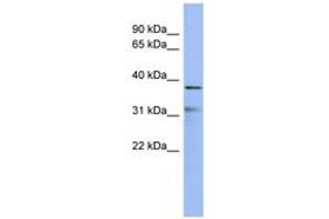 Image no. 1 for anti-Hairy/enhancer-of-Split Related with YRPW Motif 2 (HEY2) (C-Term) antibody (ABIN6742819) (HEY2 antibody  (C-Term))