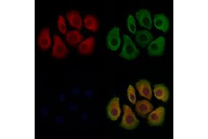 ABIN7094011 and ABIN7098055 staining Hela cells by IF/ICC. (TACO1 antibody  (Internal Region))