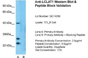 Host: Rabbit  Target Name: LCLAT1  Sample Tissue: Human 721_B cell  Lane A:  Primary Antibody Lane B:  Primary Antibody + Blocking Peptide Primary Antibody Concentration: 1 µg/mL Peptide Concentration: 5. (LCLAT1 antibody  (Middle Region))