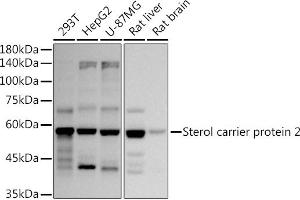 Western blot analysis of extracts of various cell lines, using (ABIN7270597) at 1:1000 dilution.