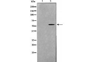 Western blot analysis on mouse brain cell lysate using DOK7 Antibody，The lane on the left is treated with the antigen-specific peptide. (DOK7 antibody  (C-Term))