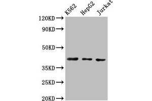 Western Blot Positive WB detected in: K562 whole cell lysate, HepG2 whole cell lysate, Jurkat whole cell lysate All lanes: CXCR3 antibody at 3 μg/mL Secondary Goat polyclonal to rabbit IgG at 1/50000 dilution Predicted band size: 41, 46, 29 kDa Observed band size: 41 kDa (CXCR3 antibody  (AA 4-50))