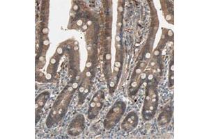 Immunohistochemical staining of human duodenum shows moderate cytoplasmic positivity in glandular cells. (SDSL antibody)