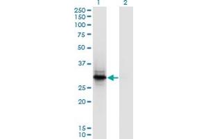 Western Blot analysis of FYCO1 expression in transfected 293T cell line by FYCO1 polyclonal antibody (A01). (FYCO1 antibody  (AA 1-255))