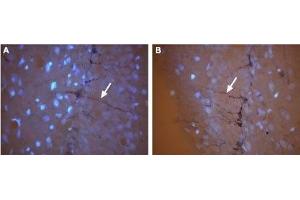 Expression of CNG3 in rat brain - Immunohistochemical staining of frozen rat hippocampal dentate gyrus (DG) sections using Anti-CNGA3 Antibody (ABIN7043091 and ABIN7044975). (CNGA3 antibody  (Intracellular))