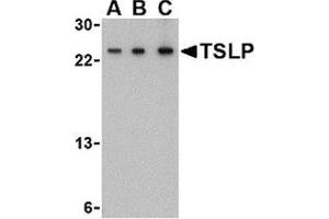Western blot analysis of TSLP in A-20 cell lysate with this product at (A) 0. (Thymic Stromal Lymphopoietin antibody  (Center))