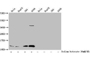 Western Blot Detected samples: Hela whole cell lysate, HepG2 whole cell lysate, 293 whole cell lysate, A549 whole cell lysate, Untreated (-) or treated (+) with 30 mM sodium butyrate for 4h All lanes: HIST1H4A antibody at 1:1000 Secondary Goat polyclonal to rabbit IgG at 1/40000 dilution Predicted band size: 12 kDa Observed band size: 12 kDa (HIST1H4A antibody  (acLys91))