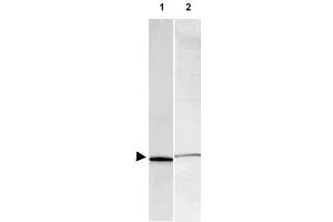 Image no. 3 for anti-S100 Calcium Binding Protein A1 (S100A1) antibody (ABIN401026) (S100A1 antibody)