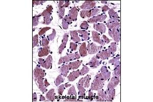 DAG1 Antibody (C-term) ((ABIN658022 and ABIN2846960))immunohistochemistry analysis in formalin fixed and paraffin embedded human skeletal muscle followed by peroxidase conjugation of the secondary antibody and DAB staining. (Dystroglycan antibody  (C-Term))