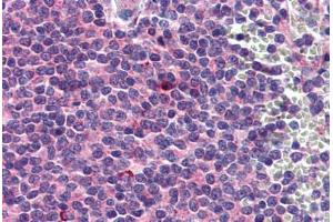 Human Spleen: Formalin-Fixed, Paraffin-Embedded (FFPE) (Septin 6 antibody  (AA 1-435))