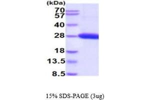 SDS-PAGE (SDS) image for UL16 Binding Protein 1 (ULBP1) (AA 26-216) protein (His tag) (ABIN5854752)