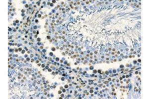 ABIN7095242 and ABIN7099299 at 1/100 staining rat testis tissue by IHC-P.