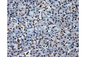 Immunohistochemical staining of paraffin-embedded Kidney tissue using anti-DAPK2 mouse monoclonal antibody.
