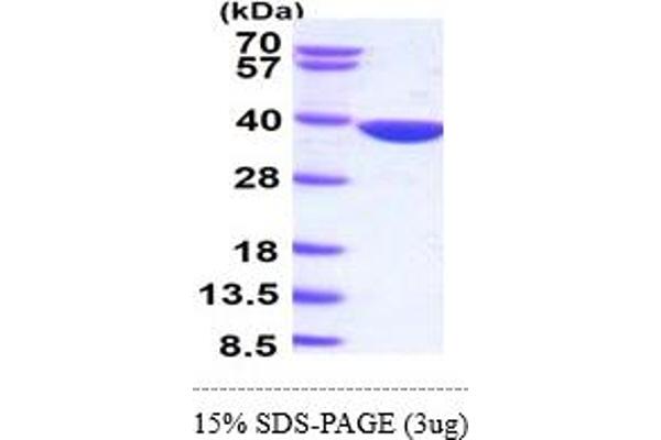 AKR1B10 Protein (AA 1-316)